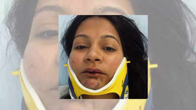 An indian couple claimed they were brutally attacked by a chinese person at a hotel in switzerland unprovoked.jpg