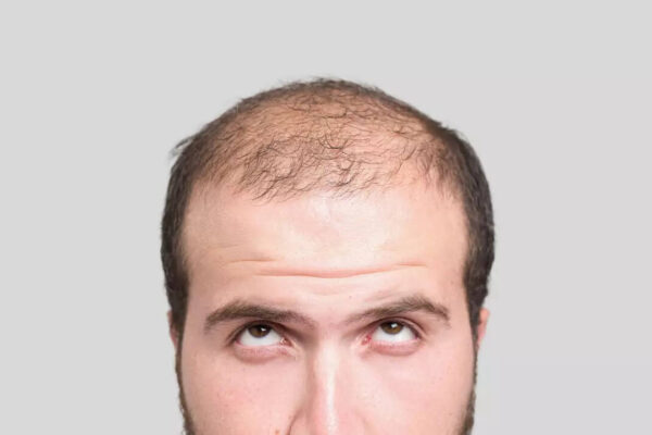 Msid 123854328imgsize 25966.cms .jpeg