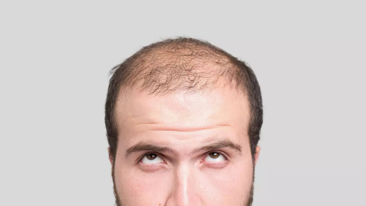 Msid 123854328imgsize 25966.cms .jpeg