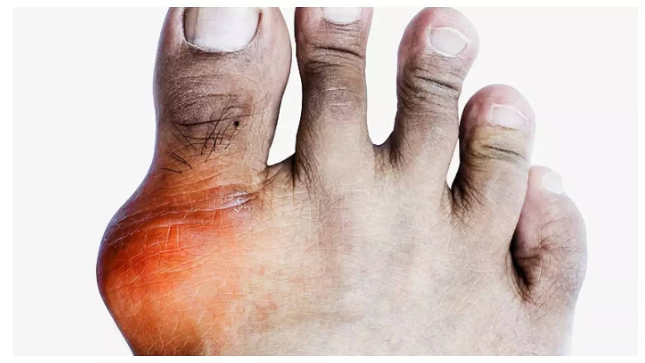 Msid 123912900imgsize 39068.cms .jpeg