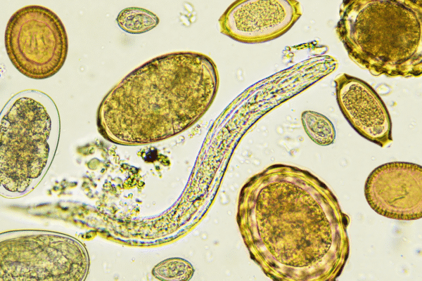 Msid 123941125imgsize 1878985.cms .png