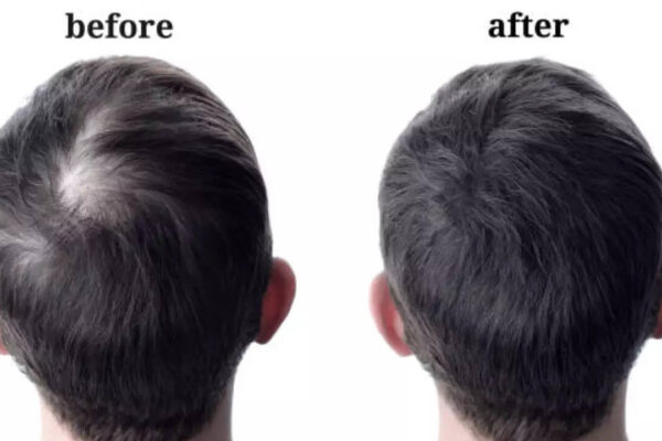 Msid 123942710imgsize 31466.cms .jpeg