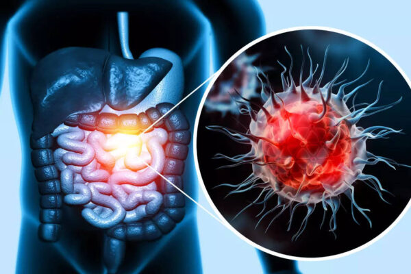 Msid 123997172imgsize 69196.cms .jpeg