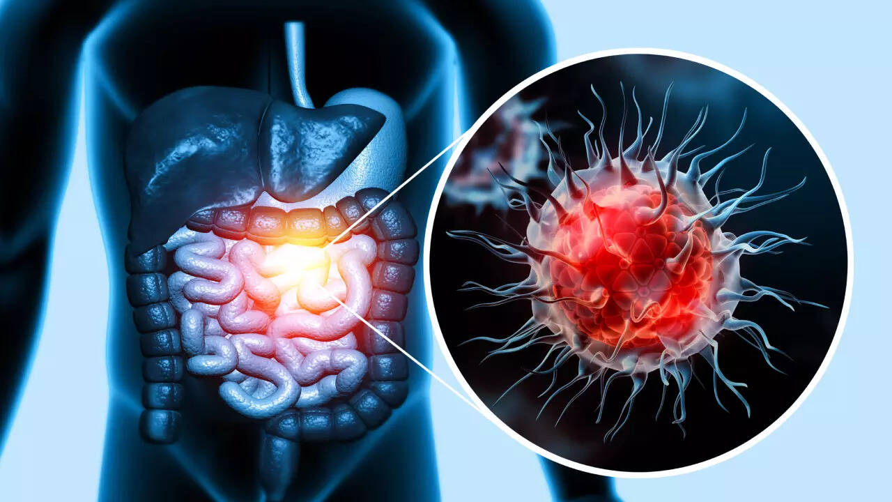 Msid 123997172imgsize 69196.cms .jpeg