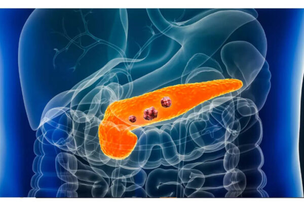 Msid 124036799imgsize 49322.cms .jpeg