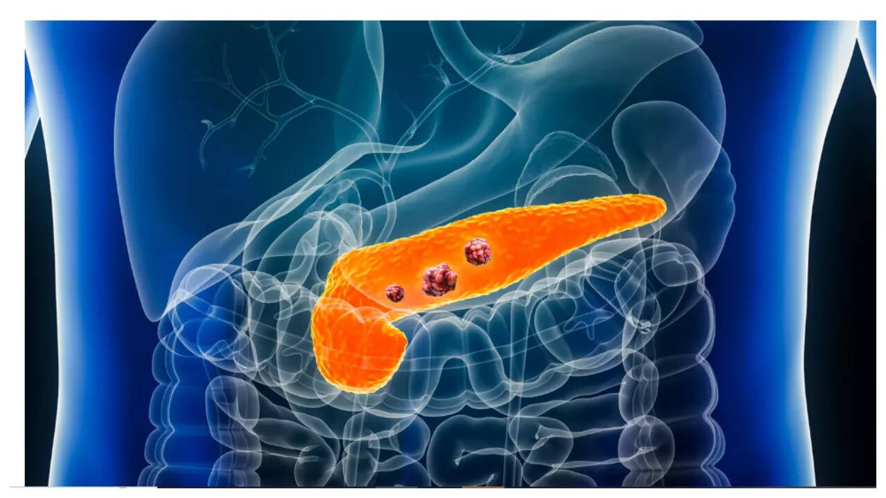 Msid 124036799imgsize 49322.cms .jpeg