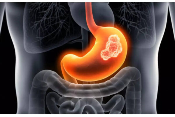 Msid 124191792imgsize 30012.cms .jpeg