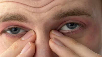 Why your eyes keep watering common causes home remedies and warning signs.jpg