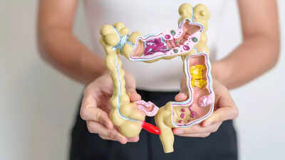 How your morning breakfast could protect you from colon cancer.jpg