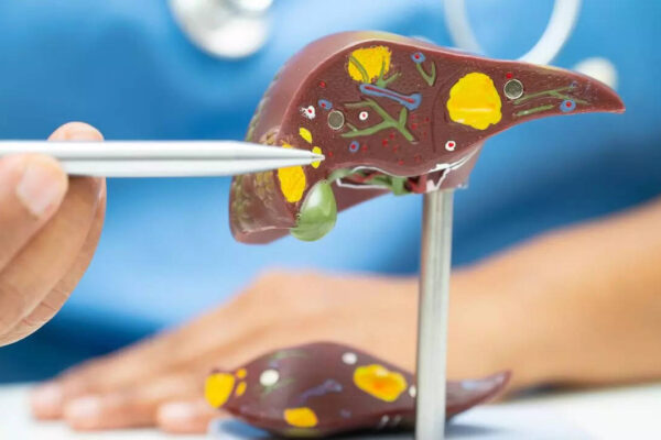 Msid 124259884imgsize 34246.cms .jpeg