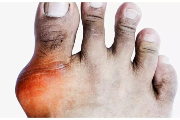 Msid 124289351imgsize 39068.cms .jpeg