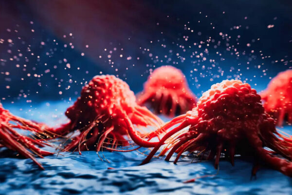 Msid 124333082imgsize 68932.cms .jpeg