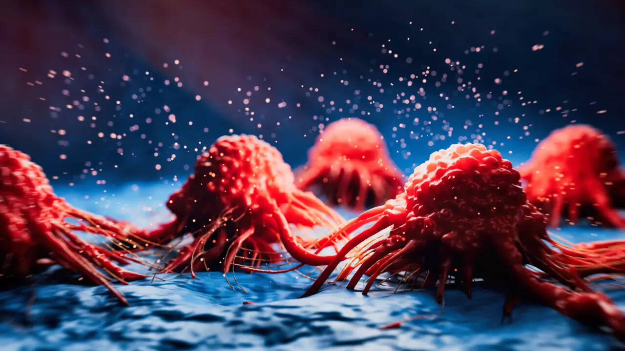 Msid 124333082imgsize 68932.cms .jpeg