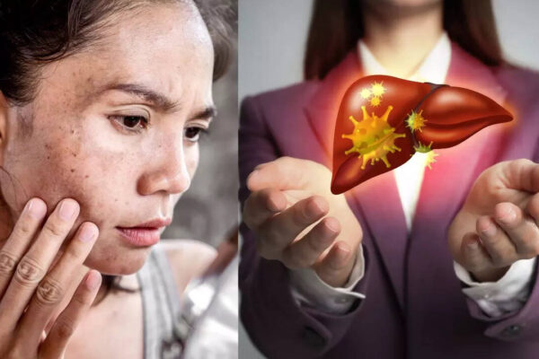 Msid 124387446imgsize 51676.cms .jpeg