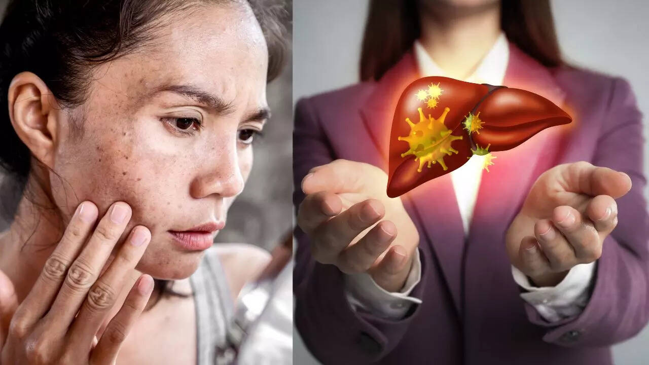 Msid 124387446imgsize 51676.cms .jpeg