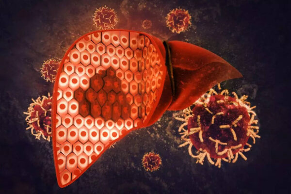 Msid 124549472imgsize 65452.cms .jpeg