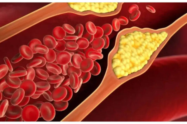 Msid 124595447imgsize 40612.cms .jpeg