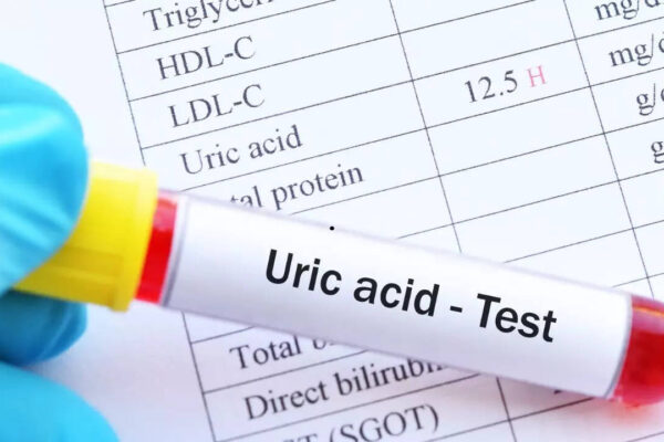 Msid 124685171imgsize 45440.cms .jpeg