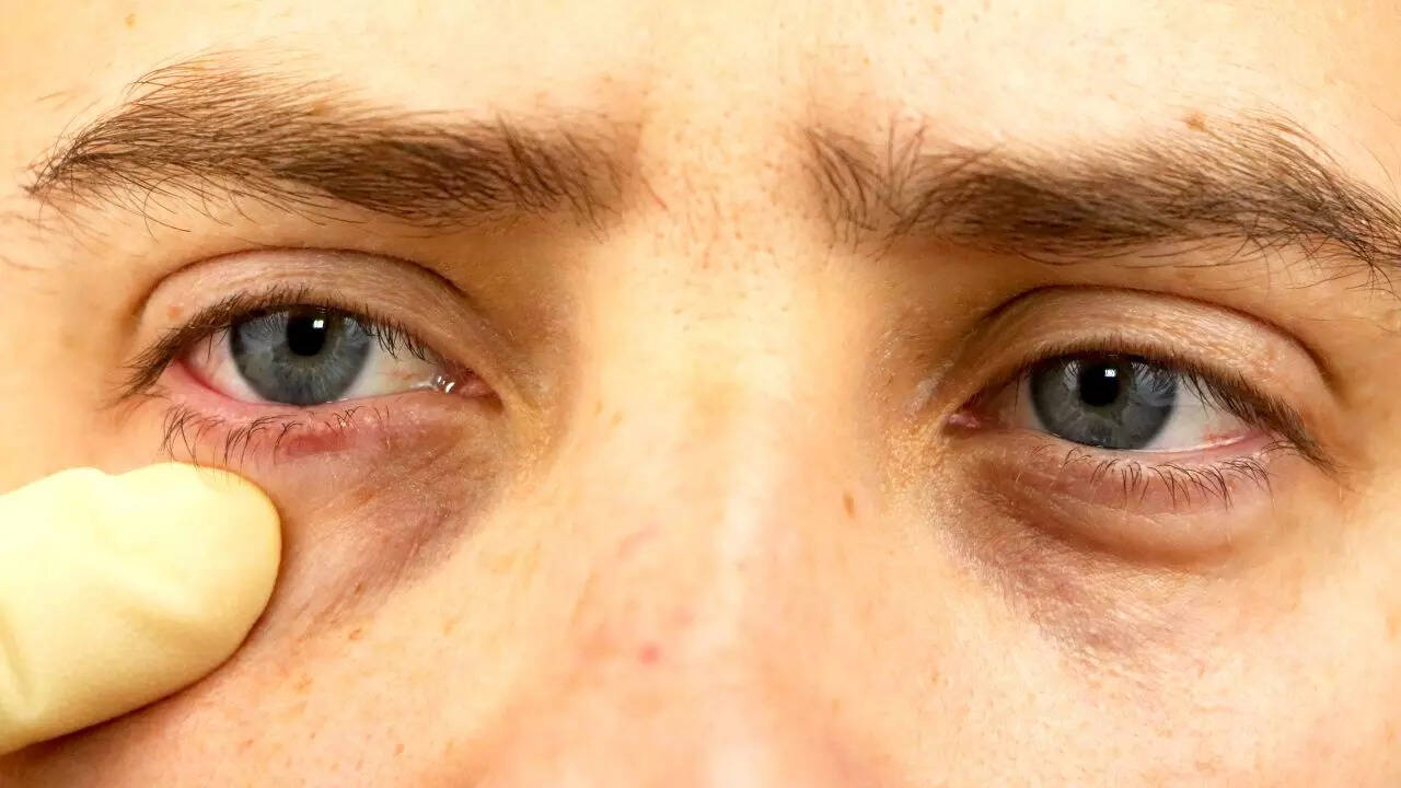 Msid 124686877imgsize 56634.cms .jpeg