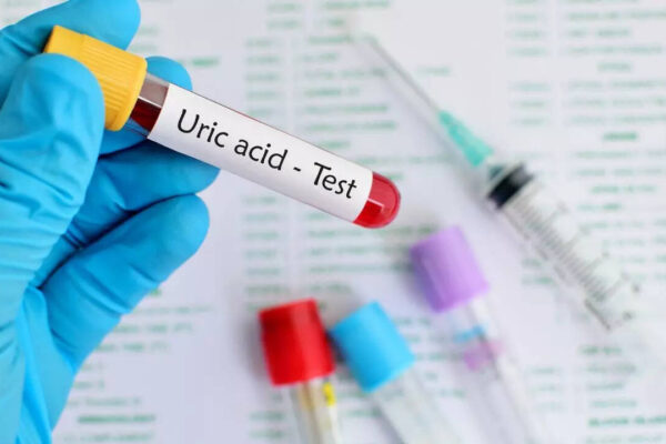 Msid 124725629imgsize 29694.cms .jpeg