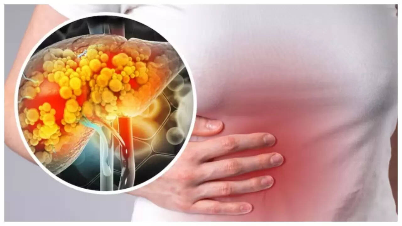 Msid 124803832imgsize 32308.cms .jpeg