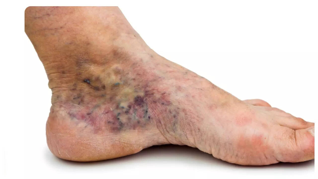 Msid 124863005imgsize 26320.cms .jpeg