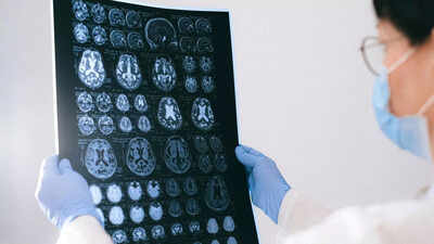 The shocking reason alzheimers targets women more than men scientists reveal.jpg