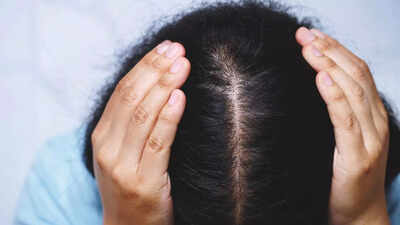 7 home remedies for dry scalp in winter natural solutions to hydrate soothe and reduce flakes.jpg