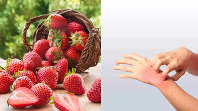 Can strawberries cause allergies know the signs causes and how to manage them.jpg