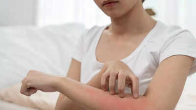 Itchy skin could be a warning sign of kidney disease what uremic pruritus feels like and how to manage it.jpg