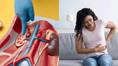 Kidney removal side effects understanding post surgery pain recovery and health risks.jpg