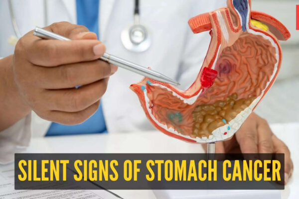 Msid 125003904imgsize 76146.cms .jpeg