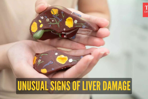 Msid 125055600imgsize 55754.cms .jpeg