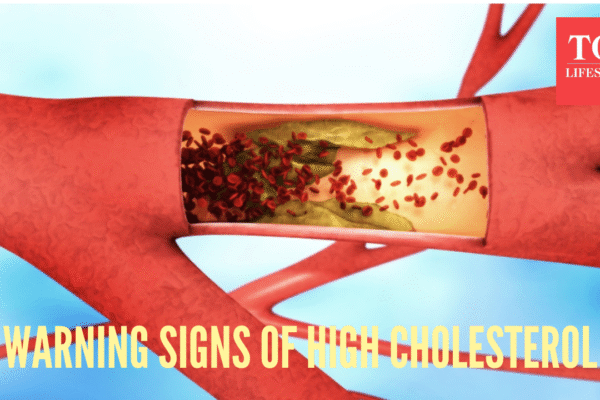 Msid 125074423imgsize 768579.cms .png