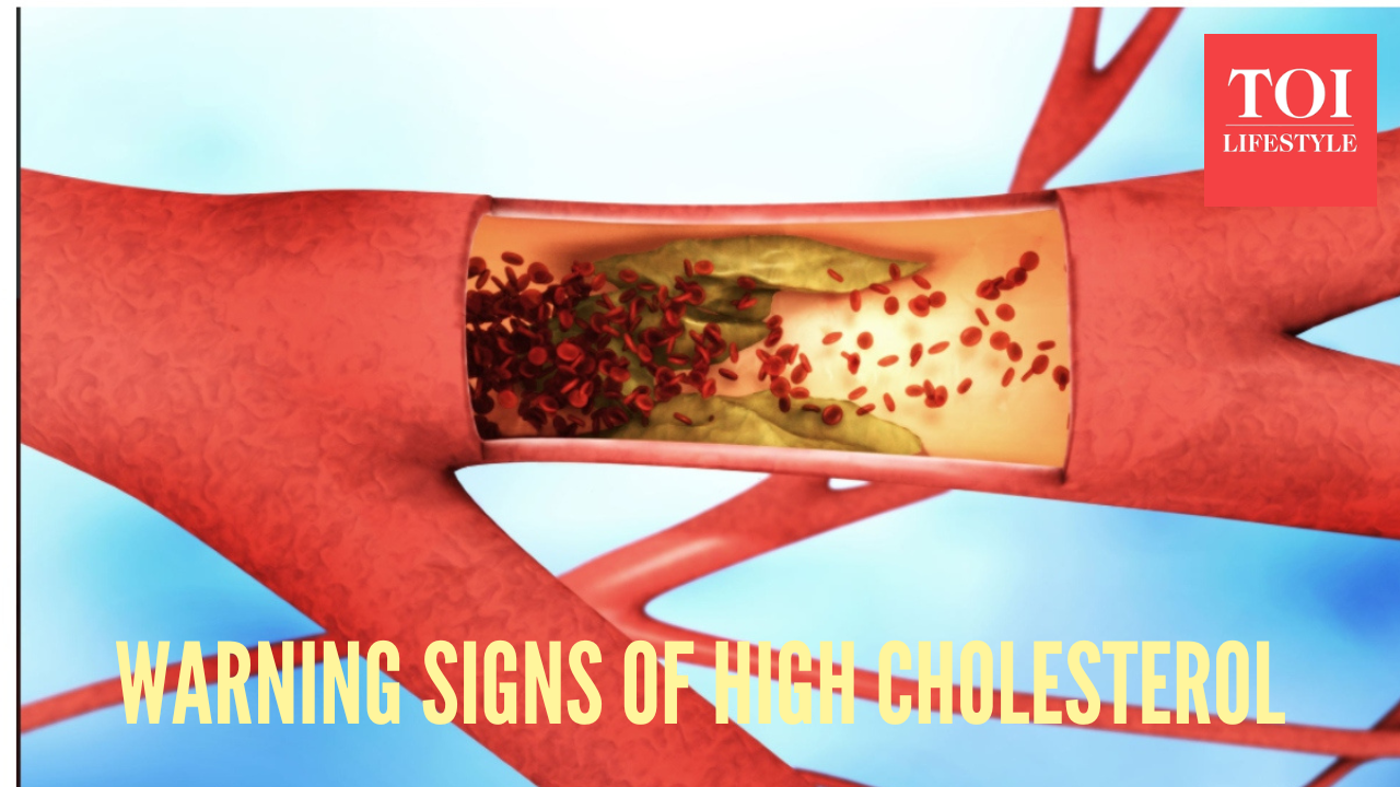 Msid 125074423imgsize 768579.cms .png