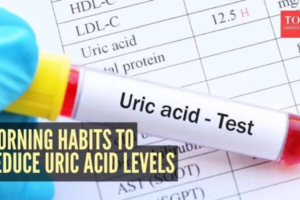 Msid 125132960imgsize 51414.cms .jpeg