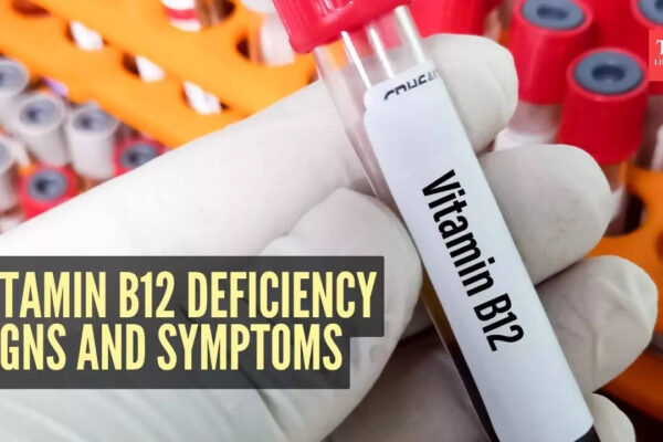 Msid 125249125imgsize 43216.cms .jpeg