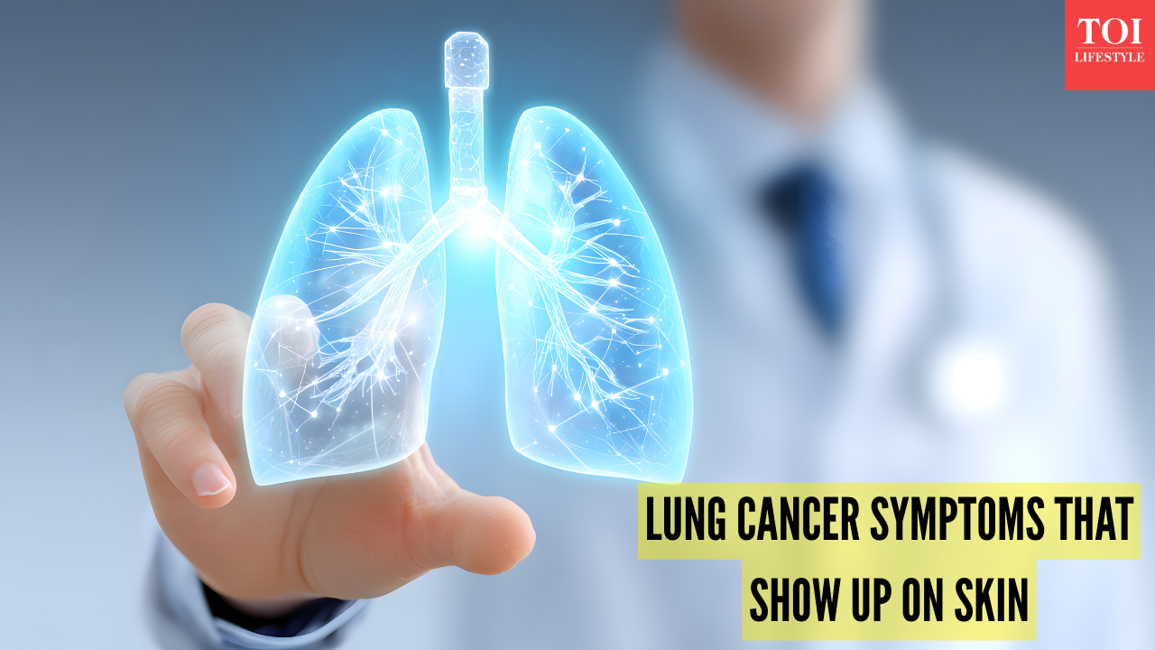 Msid 125630848imgsize 778130.cms .png