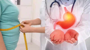 Obesity increases the risk of stomach cancer understanding the link between excess weight and digestive health.jpg