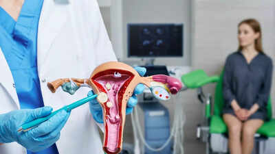 Uterine fibroids 5 subtle early warning signs you should not ignore.jpg