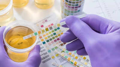 What does the colour of your urine say about your health.jpg