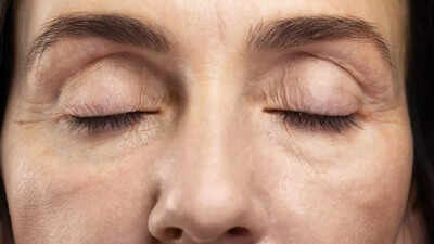 What your eyelashes say about your overall health 4 conditions you should never ignore.jpg