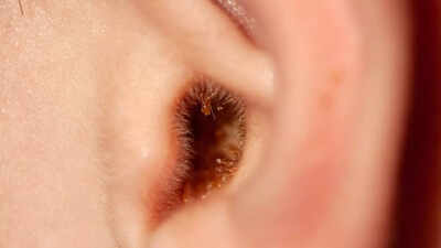 Why you should not use an earbud to clean earwax and what to do instead.jpg