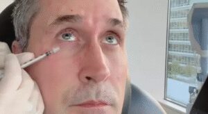 Botox.jpg