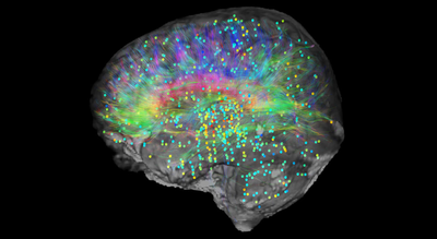 Brain and conciousness.jpg