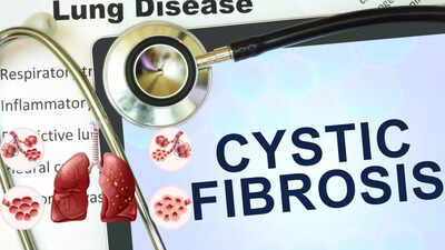 Cystic fibrosis causes symptoms diagnosis and modern treatment approaches.jpg