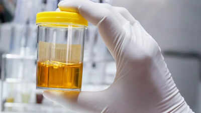 Foods and drinks that can make urine cloudy diseases and health conditions linked to it.jpg