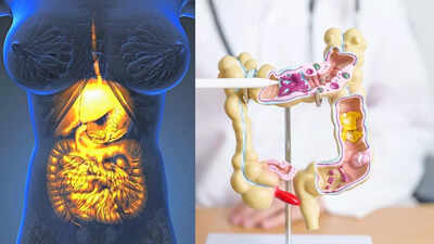 Gastroparesis vs irritable bowel syndrome symptoms treatments and differences explained.jpg