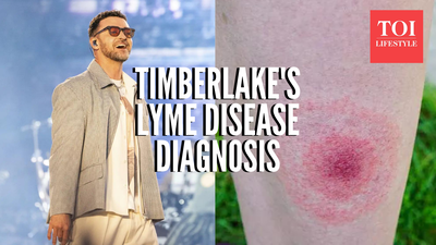 Justin timberlake39s lyme disease diagnosis.jpg