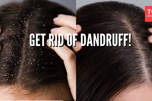 Msid 125791081imgsize 1773913.cms .png